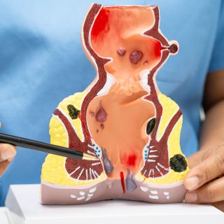 Eliminuje ból i dyskomfort